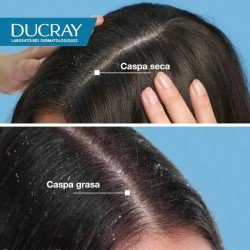 Ducray Squanorm Zinc Loción Anticaspa 200 ml