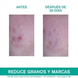 Uriage Hyseac 3 Regul+ Cuidado Global Anti-imperfecciones 40 ml