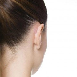 OtoStick Corrector estético de orejas 5x8 uds