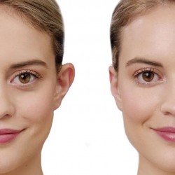 OtoStick Corrector estético de orejas 5x8 uds