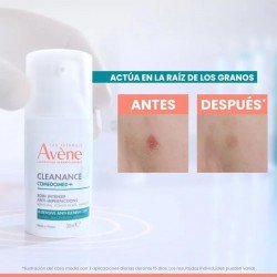 Avène Cleanance Comedomed+ Concentrado Anti-imperfecciones 30ml