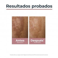 Eucerin Anti-Pigment Dual Sérum 30 ml + REGALO Minitalla Gel Limpiador