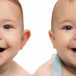 Otostick Bebé Correctores Orejas +3m 8 uds