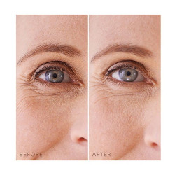 Iris Under-Eye-Patches