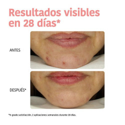 Mascarilla Peeling Piel Perfecta