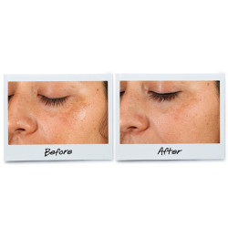 Clearly Corrective™ Dark Spot Solution