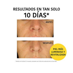 Discos Iluminadores De Piña