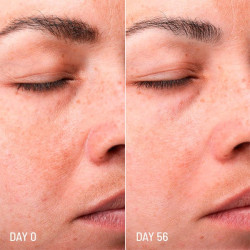 Lotus Radiance Dark Spot Treatment