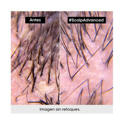 Scalp Advanced