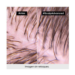 Scalp Advanced
