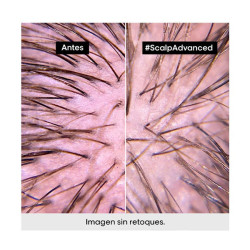 Scalp Advanced