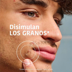 Sos Pimple Patches