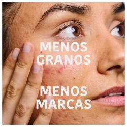 Reverent & Correct Anti-Blemish