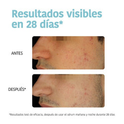 Reverent & Correct Anti-Blemish