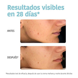 Oil Control Anti-Blemish