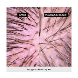 Scalp Advanced