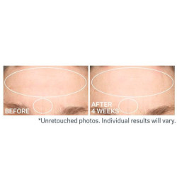 Strivectin SD Advanced Plus