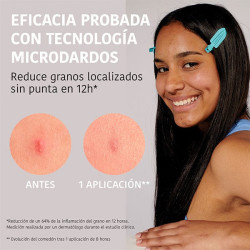 Microdarts Pimple Patches