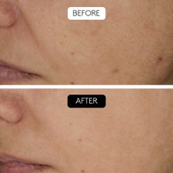 Serum Clinical Beauty Filler