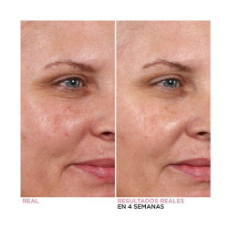 Hello Results Baby-Smooth Glycolic Peel + Caring Oil