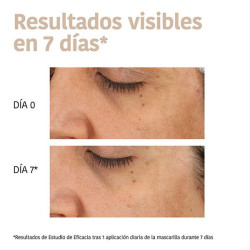 Dark Spots Tranexamic Acid