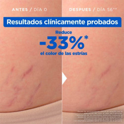 Aceite Anti-Estrías