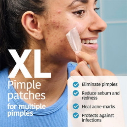 XL Pimple Patches