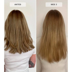 Vitaminas Crecimiento Del Cabello