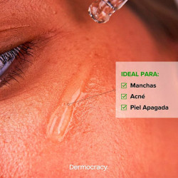 Azela+Niacin Serum 10%