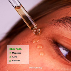 Soothing Azelaic Serum 10%