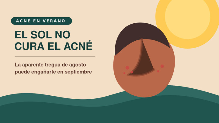 Mujer protegiendo del sol una piel con tendencia acneica en verano